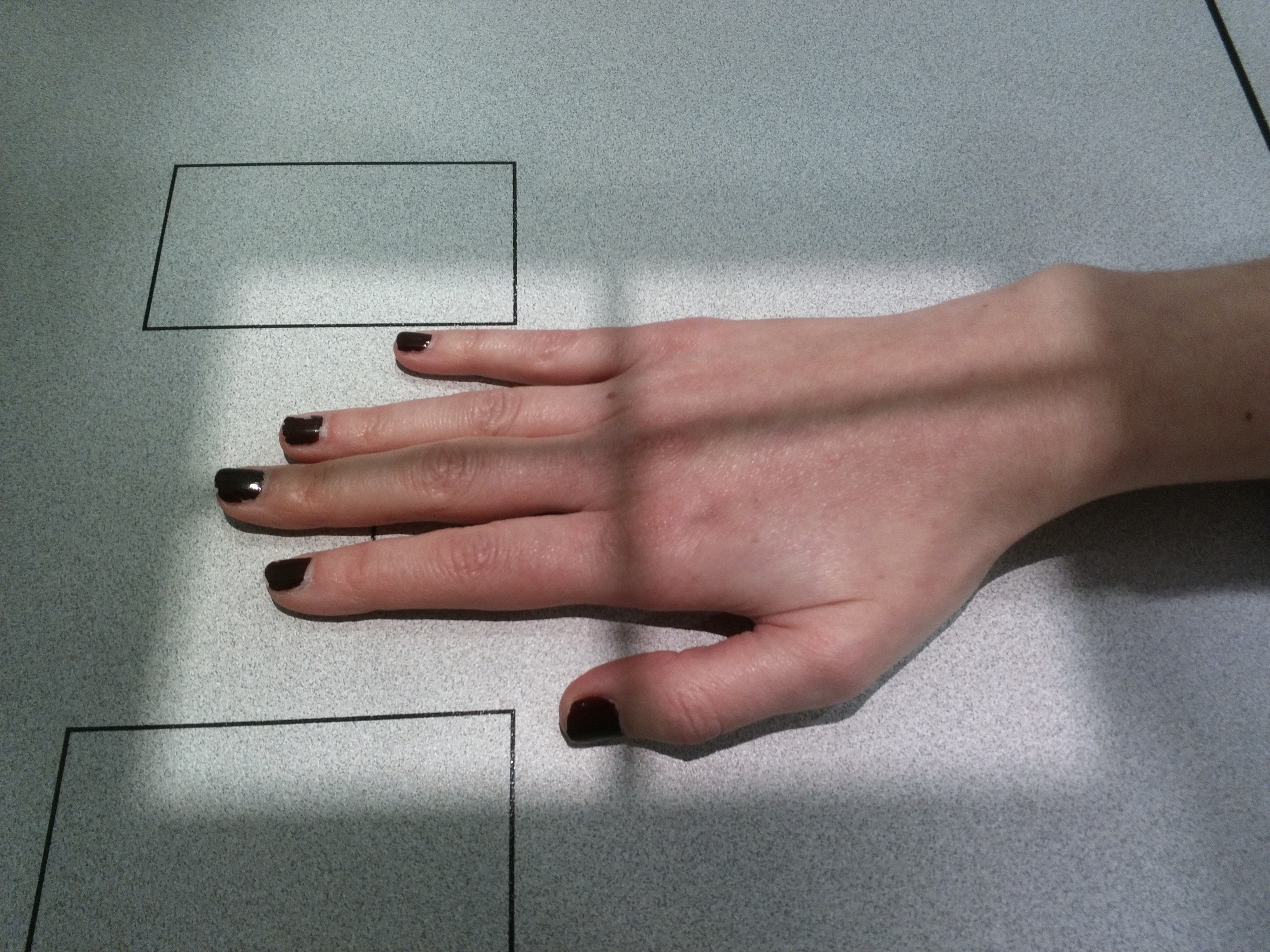 Radiografía PA mano 1